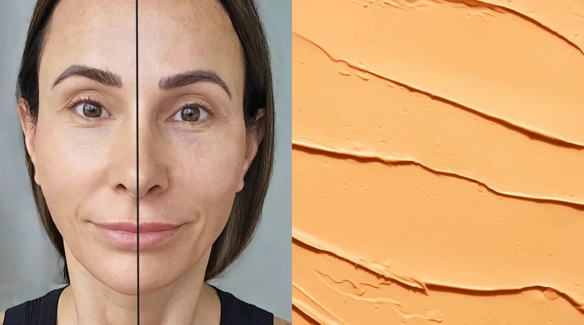 How to Hide Dark Spots on Face Naturally
