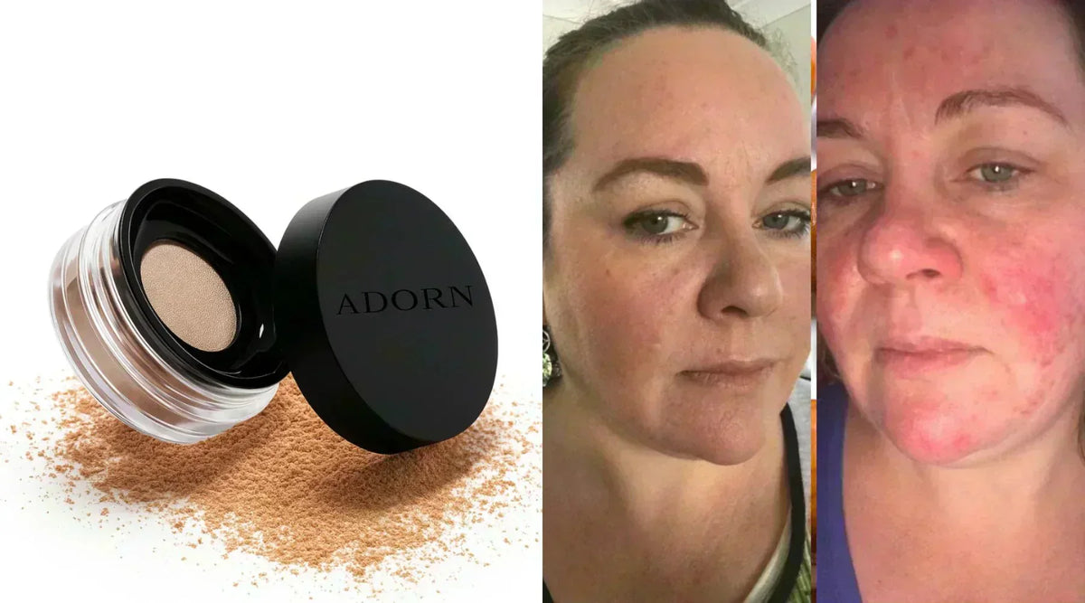 Makeup for sensitive skin and covering redness.