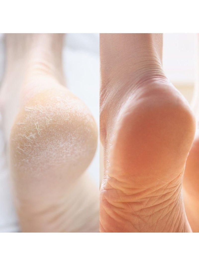 ADORN Peppermint Feet Treat Set