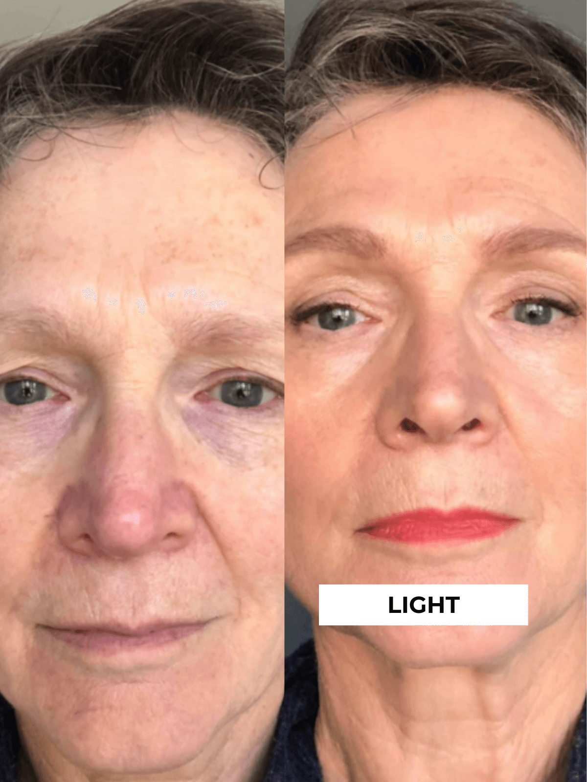 Before and after comparison of a person's face with 'Light' label between them.