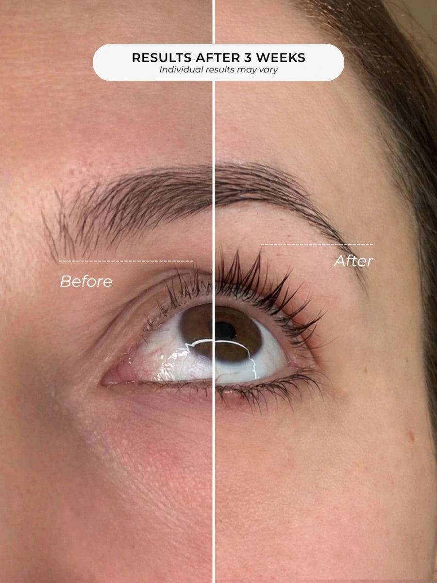 Before and after brow results after 3 weeks with Adorn peptide lash and brow serum