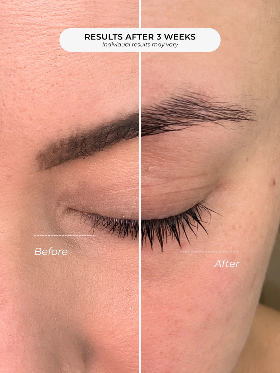 Before and after eyebrow density after 3 weeks — Adorn peptide brow serum