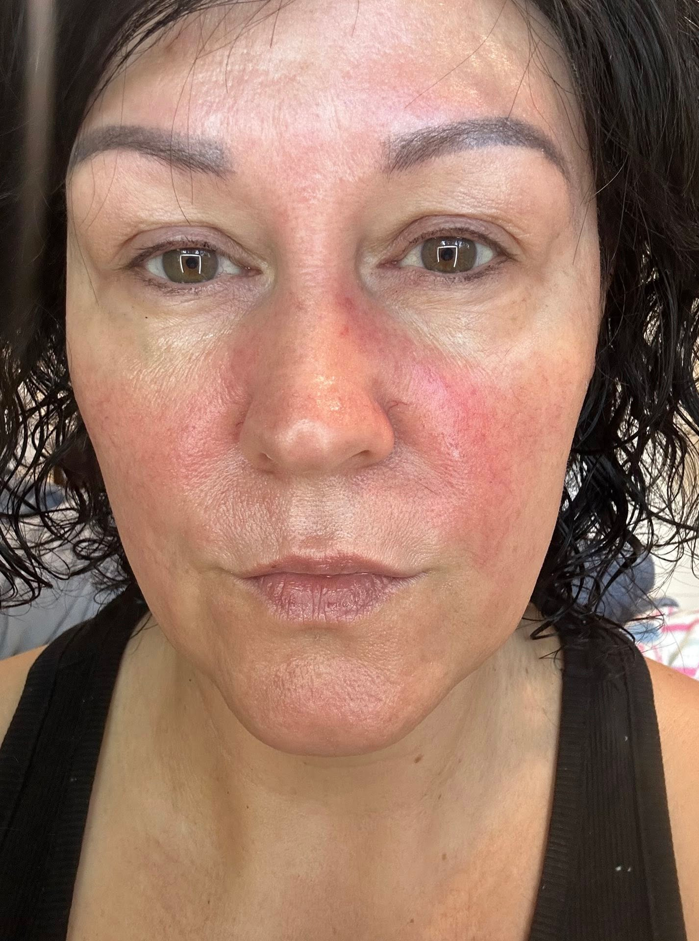 Close-up of a person with visible facial lines and skin texture.