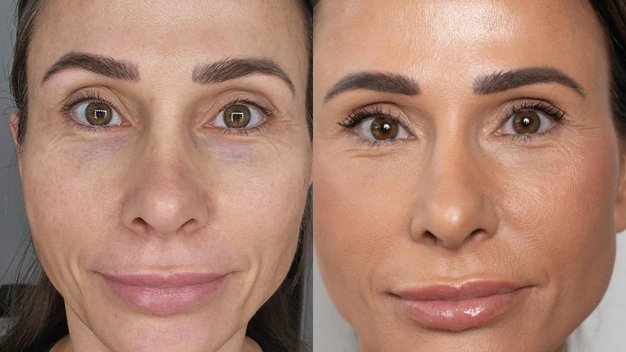Before and after comparison of Peachy Sleep Concealer.