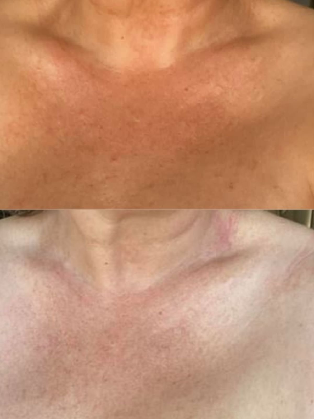 Long-Lasting Self Tanner Mousse - Adorn Cosmetics