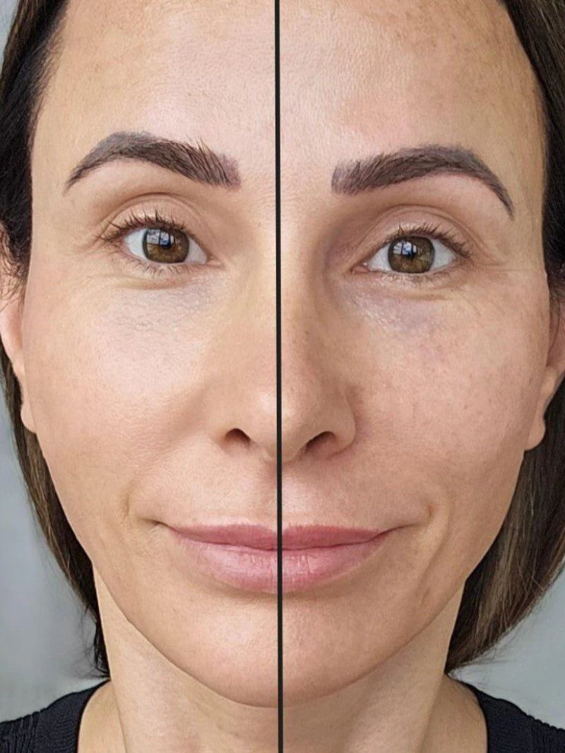 Before and after Adorn SPF 20+ mineral foundation in shade Light Medium on mature skin – soft-focus coverage of redness and pigmentation.