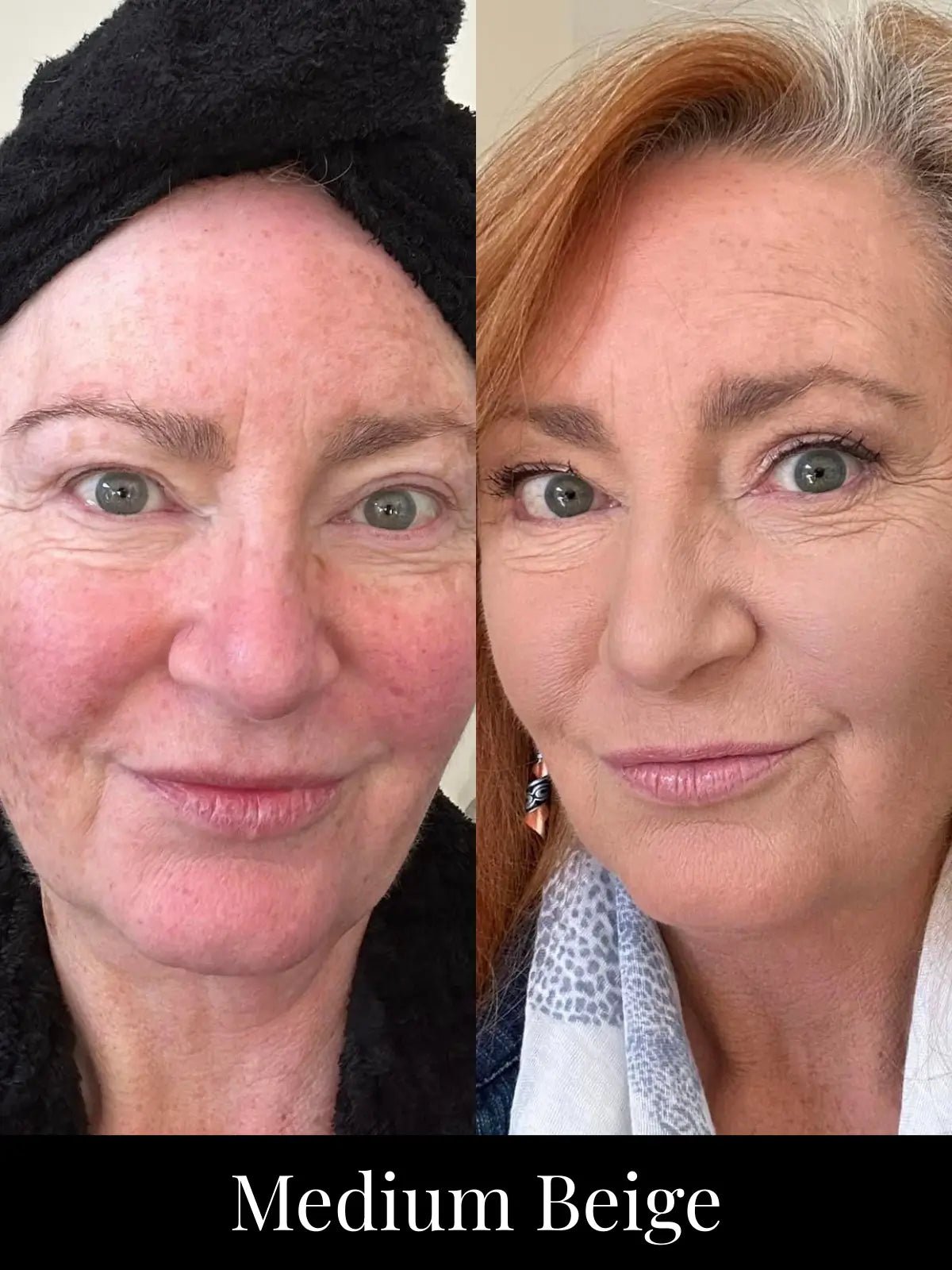 SPF 20 Makeup + Skincare Starter Set | Limited Edition - Adorn Cosmetics