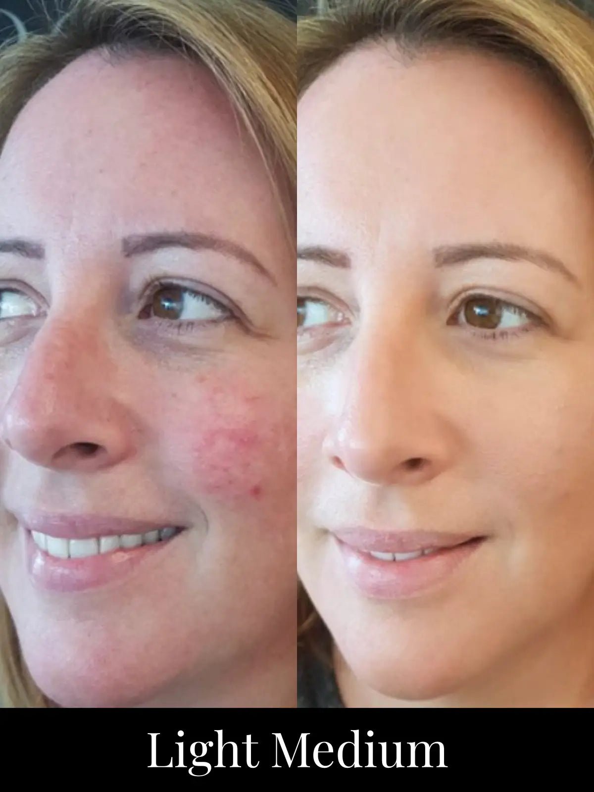 SPF 20 Makeup + Skincare Starter Set | Limited Edition - Adorn Cosmetics